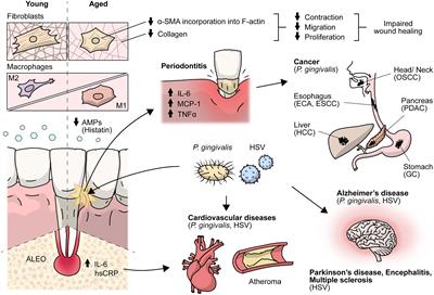 Aging envisage imbalance of the periodontium: A keystone in oral disease and systemic health